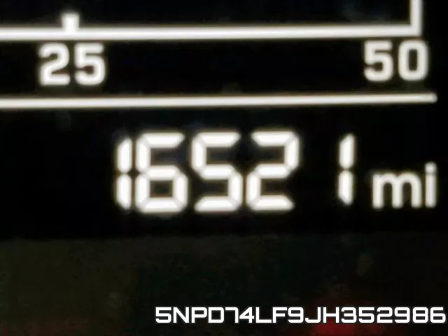 5NPD74LF9JH352986 фото 9