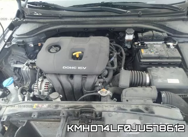 KMHD74LF0JU578612 фото 2