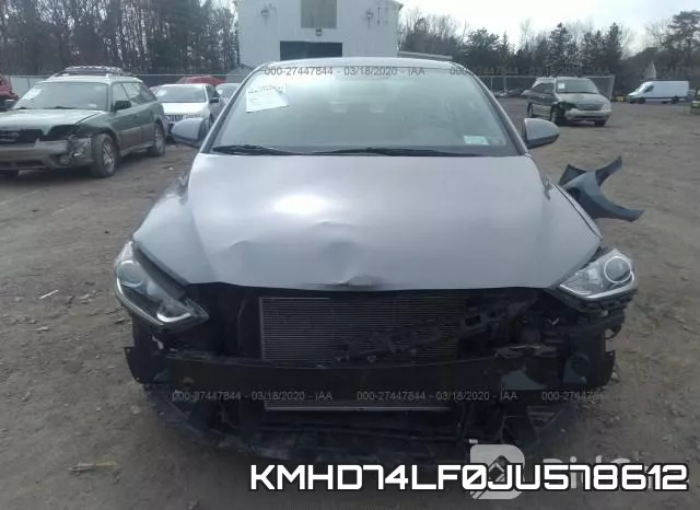KMHD74LF0JU578612 фото 7