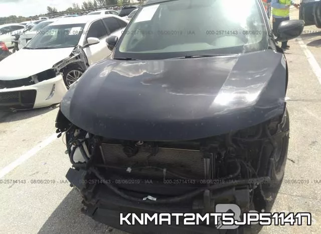 KNMAT2MT5JP511417 фото 7