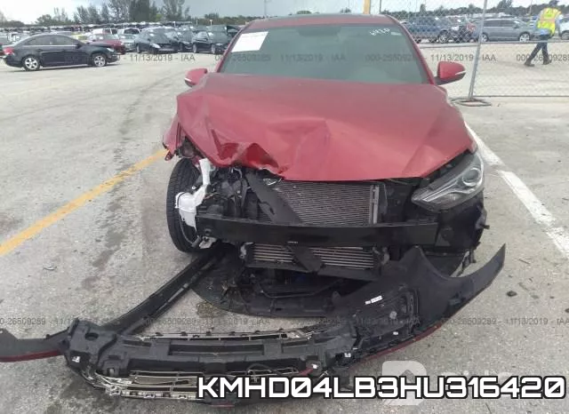 KMHD04LB3HU316420 фото 7