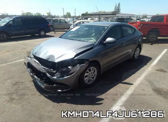 KMHD74LF4JU611286 фото 3