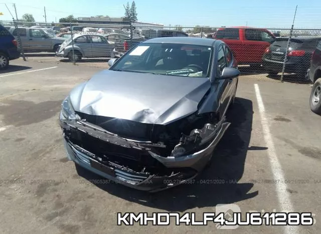 KMHD74LF4JU611286 фото 7