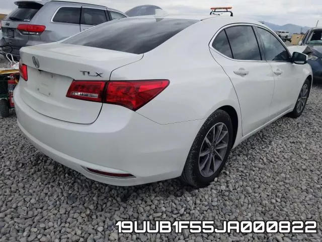19UUB1F55JA000822 фото 5