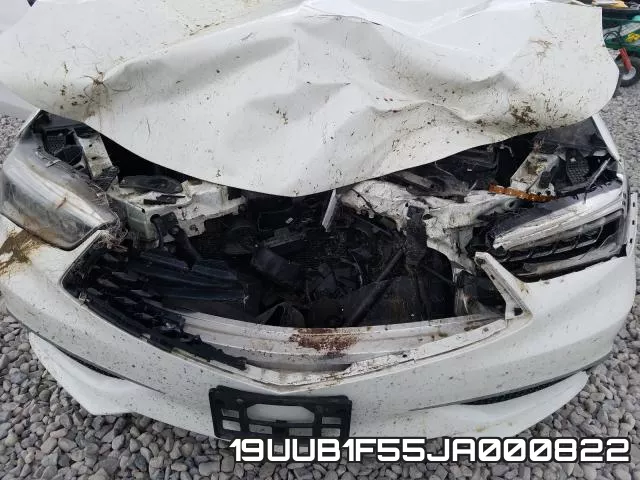19UUB1F55JA000822 фото 8