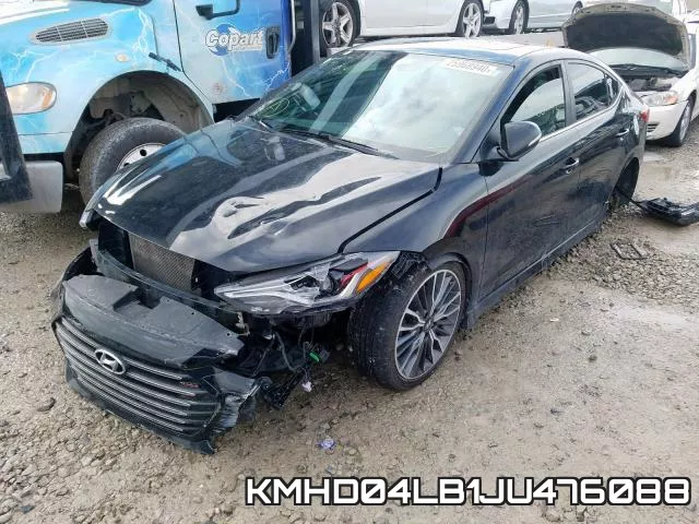 KMHD04LB1JU476088 фото 3