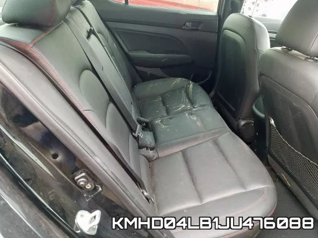 KMHD04LB1JU476088 фото 7