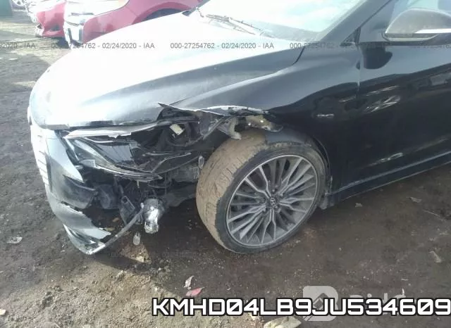 KMHD04LB9JU534609 фото 7
