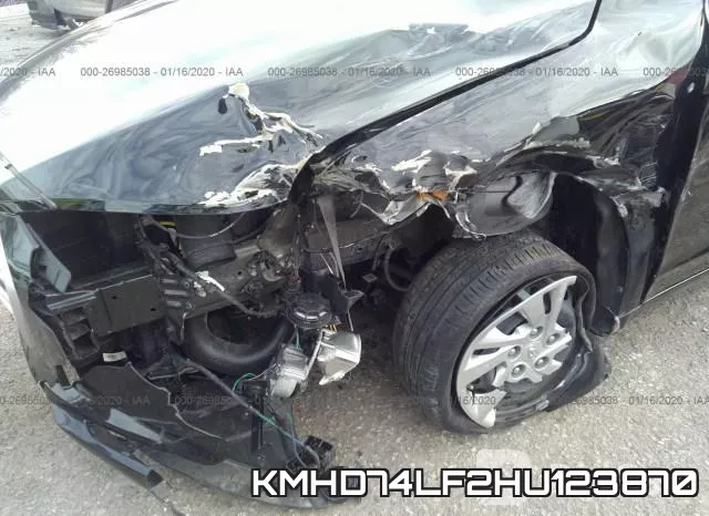 KMHD74LF2HU123870 фото 7