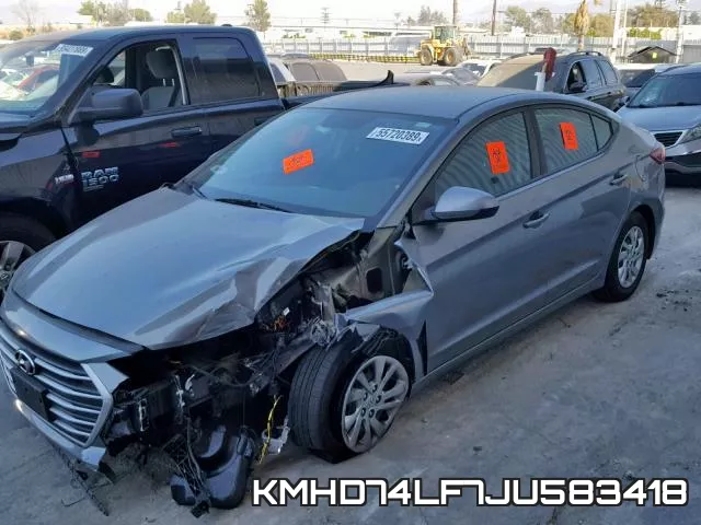 KMHD74LF7JU583418 фото 3