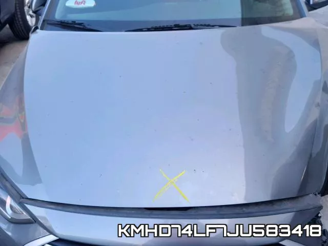 KMHD74LF7JU583418 фото 8