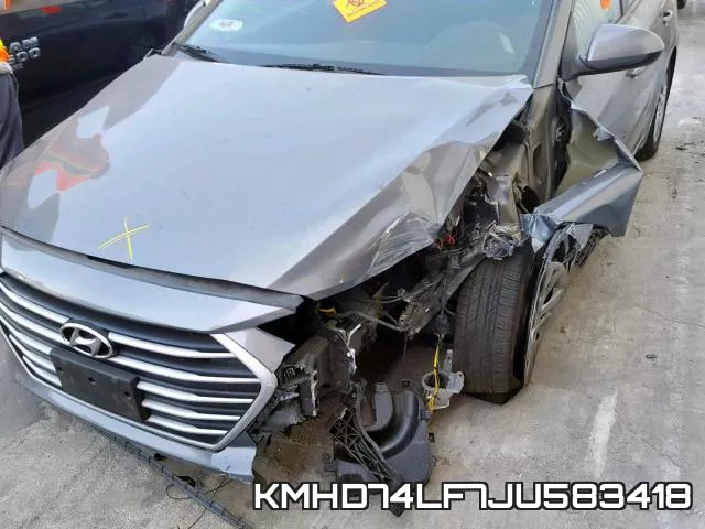 KMHD74LF7JU583418 фото 10