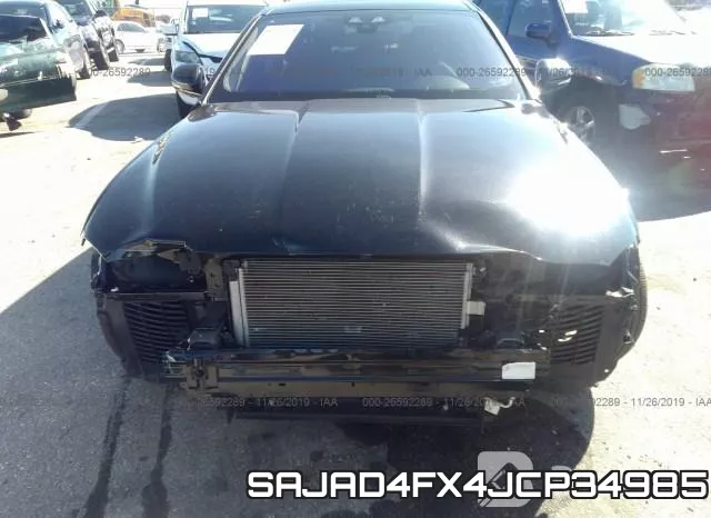 SAJAD4FX4JCP34985 фото 7