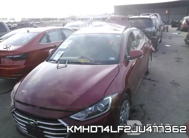 KMHD74LF2JU477362 фото 3