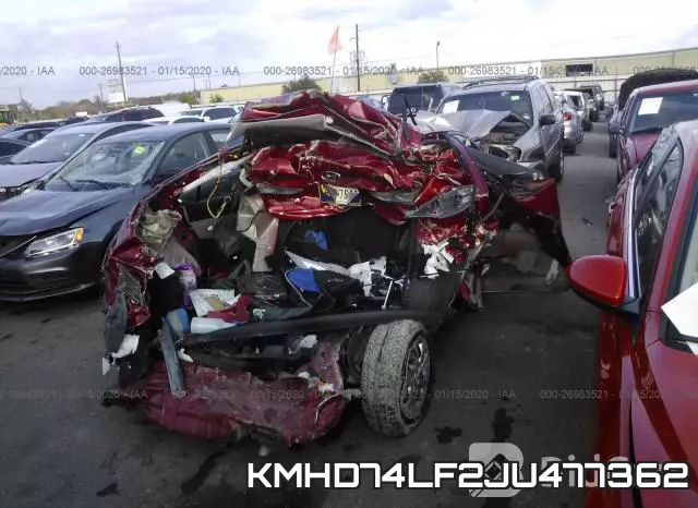 KMHD74LF2JU477362 фото 5