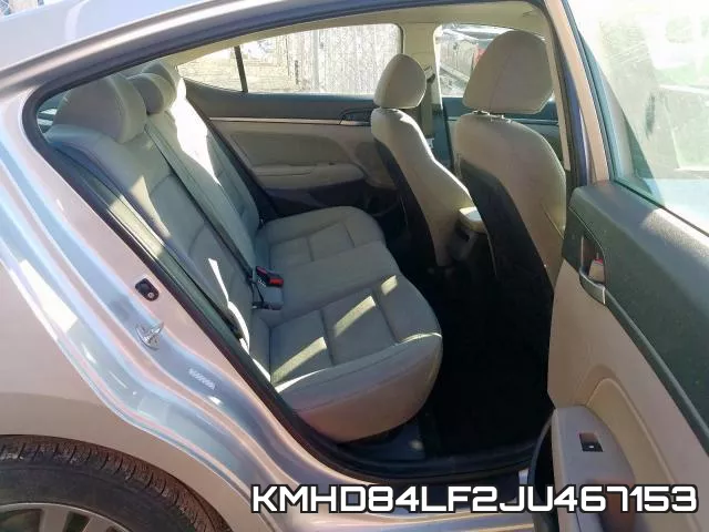 KMHD84LF2JU467153 фото 7