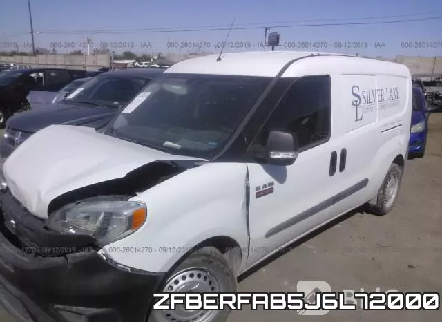 ZFBERFAB5J6L72000 фото 3