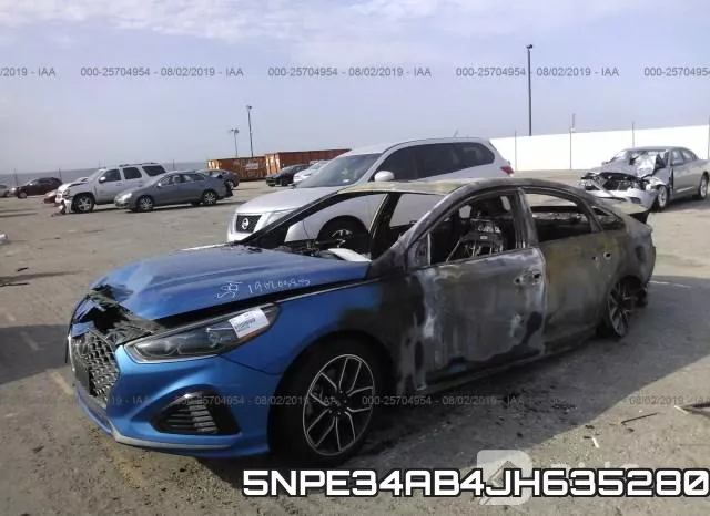 5NPE34AB4JH635280 фото 3
