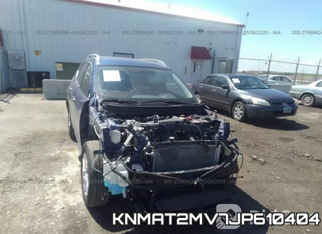 KNMAT2MV7JP610404 фото 7