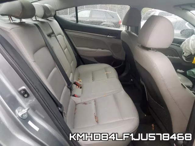 KMHD84LF1JU578468 фото 7