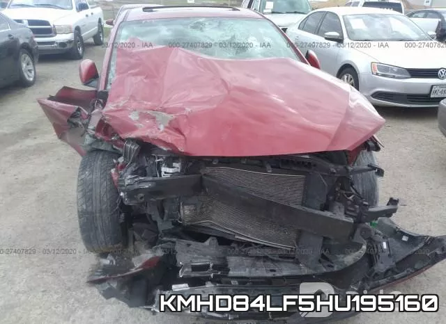 KMHD84LF5HU195160 фото 7