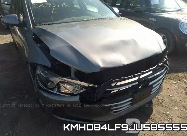 KMHD84LF9JU585555 фото 6