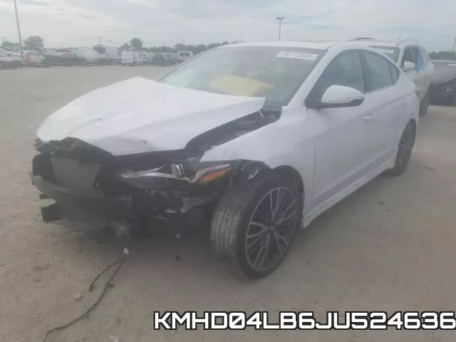 KMHD04LB6JU524636 фото 3