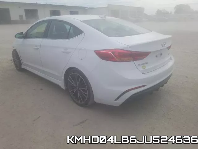 KMHD04LB6JU524636 фото 4