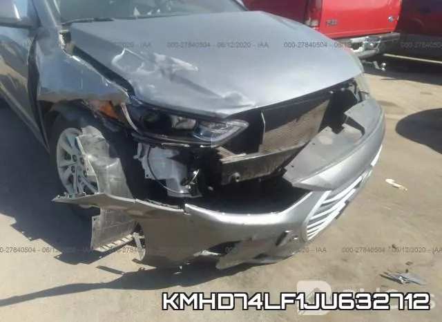 KMHD74LF1JU632712 фото 7