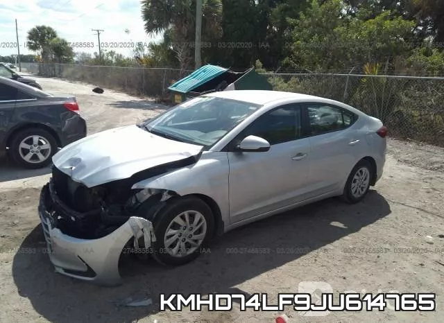 KMHD74LF9JU614765 фото 3