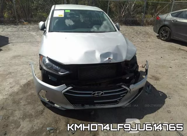 KMHD74LF9JU614765 фото 7