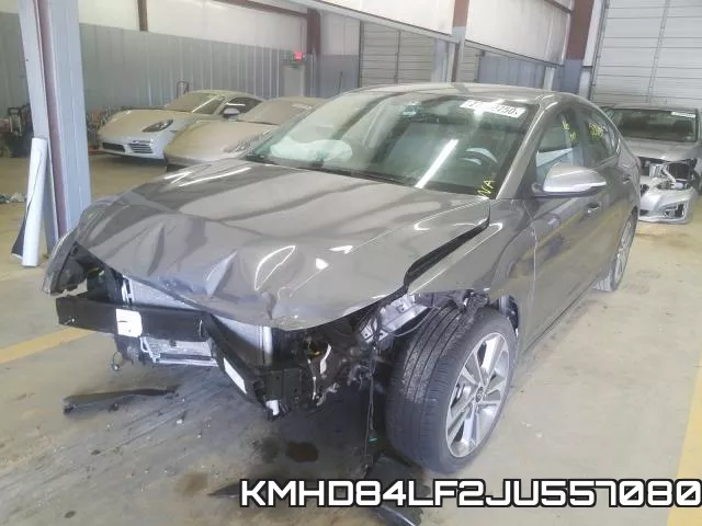 KMHD84LF2JU557080 фото 3