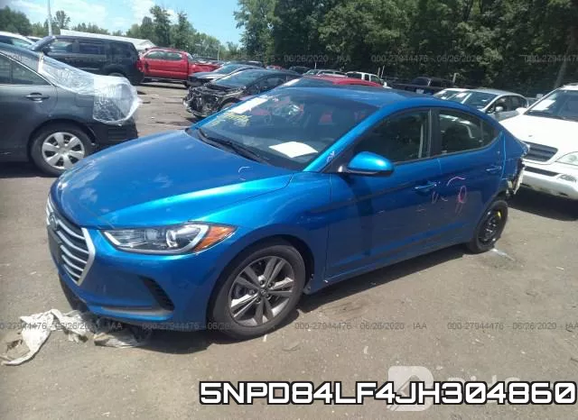 5NPD84LF4JH304860 фото 3