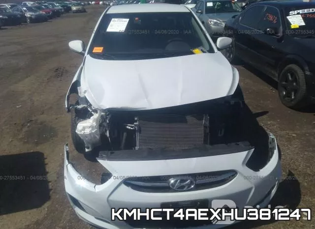KMHCT4AEXHU381247 фото 7