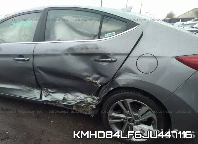 KMHD84LF6JU447116 фото 7