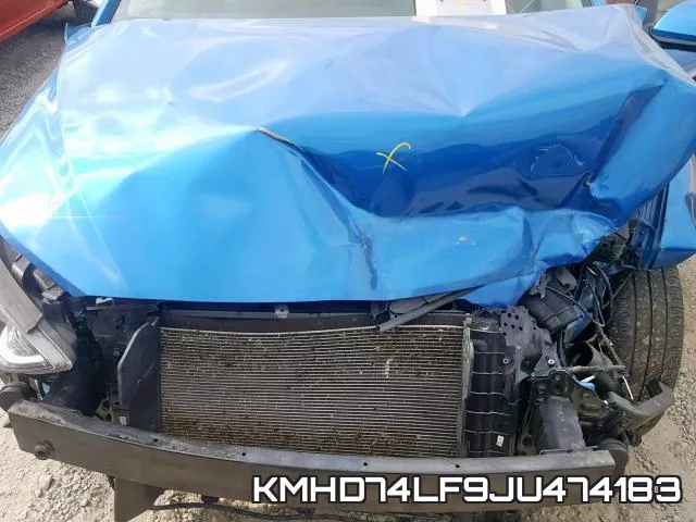 KMHD74LF9JU474183 фото 8