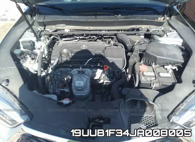 19UUB1F34JA008005 фото 2