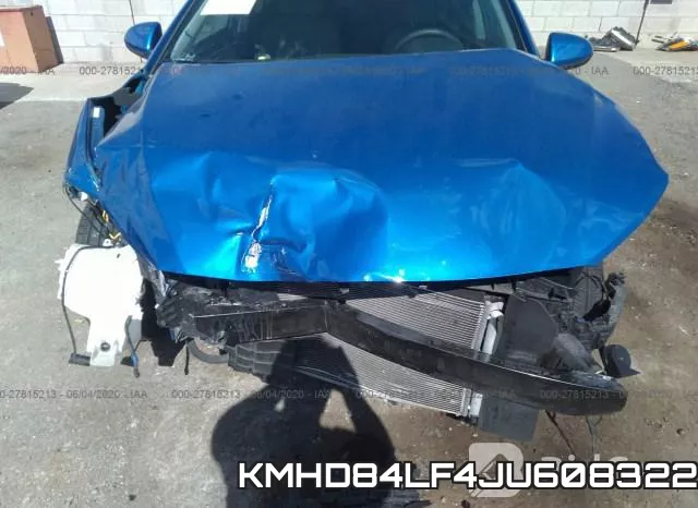 KMHD84LF4JU608322 фото 7