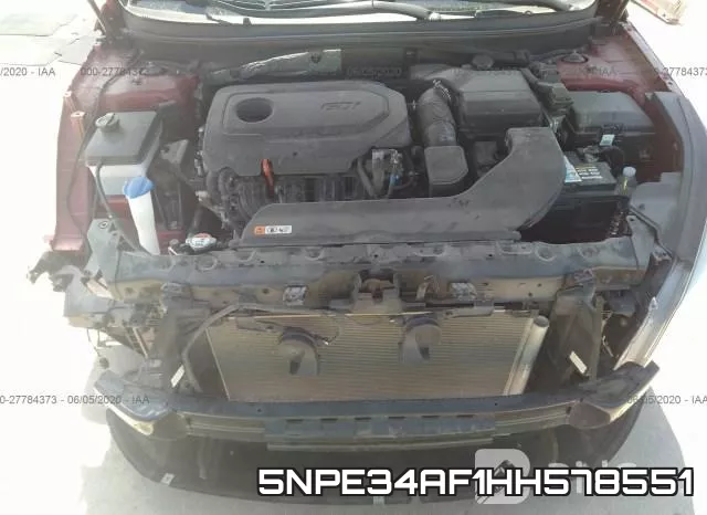 5NPE34AF1HH578551 фото 2