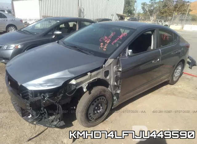 KMHD74LF7JU449590 фото 3