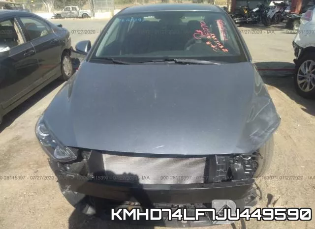 KMHD74LF7JU449590 фото 7