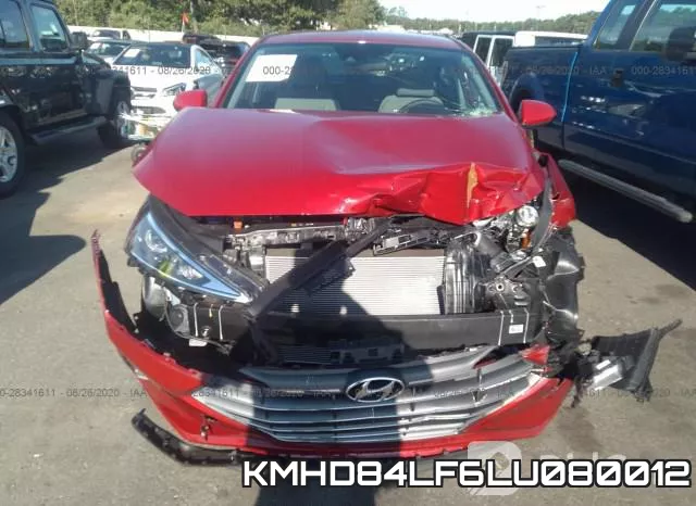 KMHD84LF6LU080012 фото 7