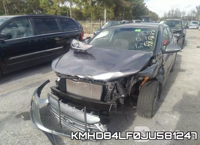 KMHD84LF0JU581247 фото 7