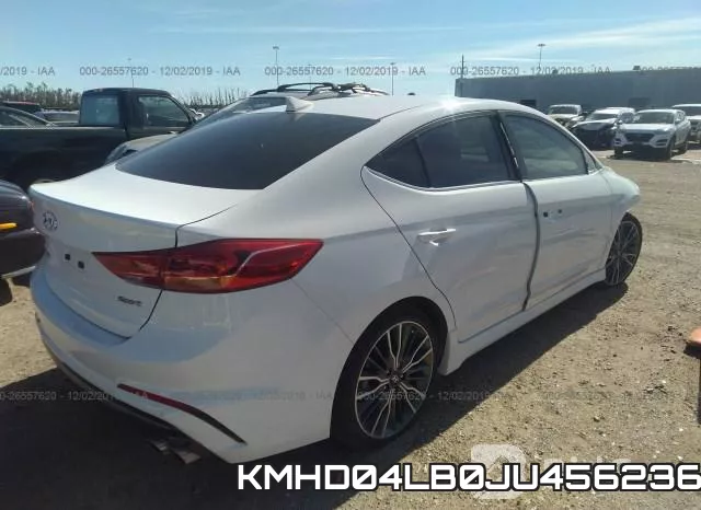 KMHD04LB0JU456236 фото 5