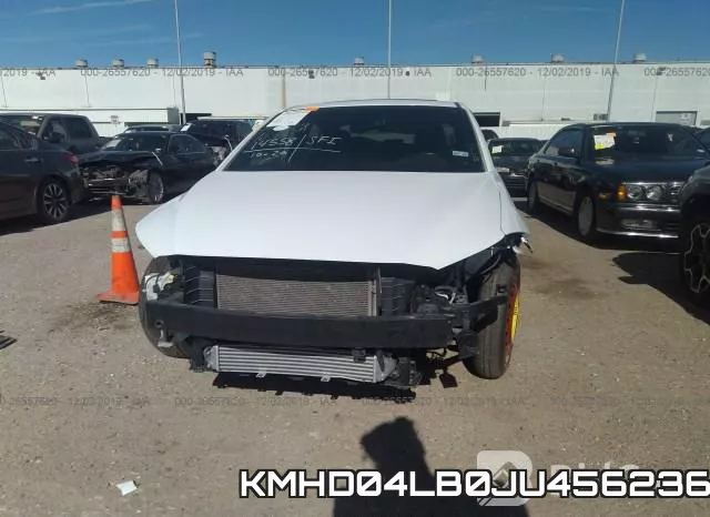 KMHD04LB0JU456236 фото 7