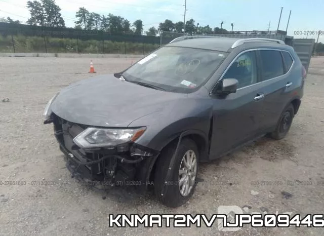 KNMAT2MV7JP609446 фото 3