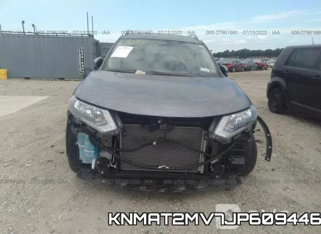 KNMAT2MV7JP609446 фото 7