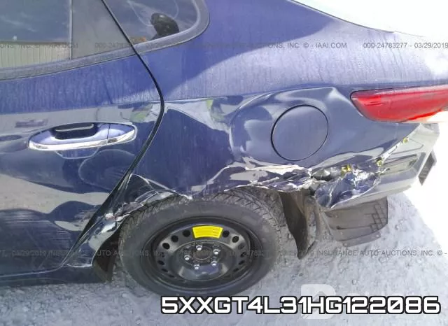 5XXGT4L31HG122086 фото 7