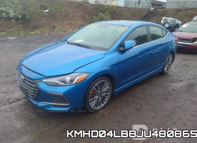 KMHD04LB8JU480865 фото 3