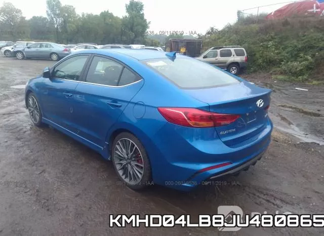 KMHD04LB8JU480865 фото 4